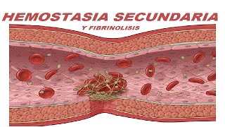 Hemostasia Secundaria Vía Extrínseca Intrínseca Común Factores de coagulación y Fibrinolisis [upl. by Ynelram]