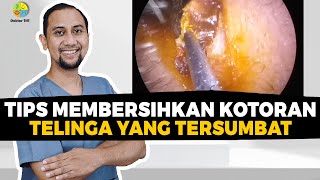 Tips Membersihkan Kotoran Telinga Yang Tersumbat  Dokter Tht [upl. by Clarkson128]