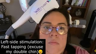 Transcranial magnetic stimulation TMS Day 4 for depressionanxiety dreading going back to work [upl. by Etnwahs]