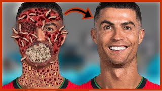 UR Cristiano Ronaldo ASMR Animation Remove Worm Infected Face  Deep Cleaning ASMR  Universe ASMR [upl. by Asylla]