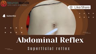 Mastering Superficial Abdominal reflex  Normal amp Absent reflex umnlesion reflexes [upl. by Anivahs]