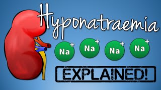 Hyponatremia EXPLAINED with Animation [upl. by Orvah76]