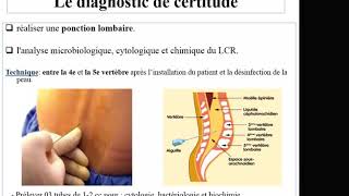 Méningites de lenfant Pr Bouchetara pédiatrie canada france [upl. by Lede]