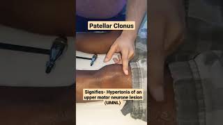 Patellar Clonus signifies hypertonia of an upper motor neurone lesion mbbs neet medicine usmle [upl. by Ogdon]