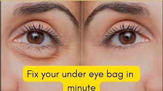 HOW TO GET RID OF PUFFY EYES  DARK UNDER EYES IN MINUTES [upl. by Martel]