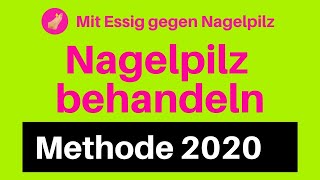 Nagelpilz Behandlung Essig gegen Nagelpilz 2020 entfernen loswerden [upl. by Naej981]