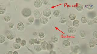 Urinalysis Explained [upl. by Adnamma]