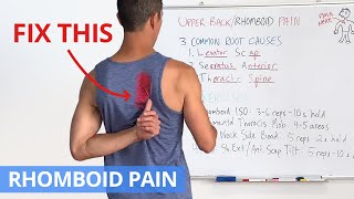 How to Fix Upper Back  Rhomboid Pain for GOOD 4 Effective Exercises [upl. by Mathur288]