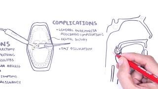 Acute Tonsillitis  causes viral bacterial pathophysiology treatment tonsillectomy [upl. by Nittirb392]