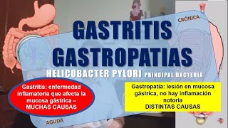 GASTRITIS y GASTROPATÍA [upl. by Gail685]