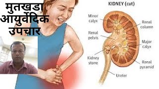 मुतखडा घरगुती उपाय मराठी  Mutkhada upchargharguti upay marathi  kidney stone treatment [upl. by Iatnohs]