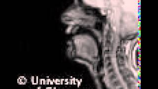 MRI voiced pharyngeal fricative [upl. by Norrehc]