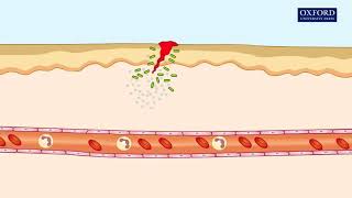 Animation 241 Inflammatory response [upl. by Aitra]