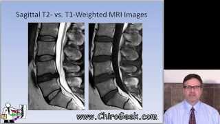 Dr Gillard lectures on How to Read Your Lumbar MRI [upl. by Hakaber]