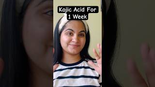 Kojic Acid Challenge for 1 Week  How to use Kojic Acidkojicacidhyperpigmentationskincareshorts [upl. by Neeham]