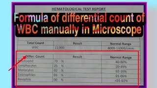 Formula Of Differential Count Of WBC Manually In Microscopewbc count formulacbc test [upl. by Donalt]