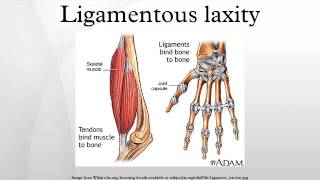 Ligamentous laxity [upl. by Ibok]