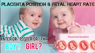 PLACENTA POSITION AND FHR VS BABY GENDER anterior placenta posteriorplacenta boybaby girlbaby [upl. by Kittie]