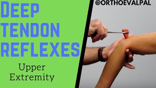 Deep Tendon Reflexes of the Upper Extremities [upl. by Sallyanne486]