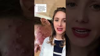 Tratamiento con Isotretinoína para el acné acne isotretinoina isotretinoin salud farmacc farma [upl. by Renruojos193]