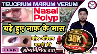 NASAL POLYP Treatment  Teucrium Marum Verum  नाक के मास को गलाने की अचूक दवा  Ascarides Worms [upl. by Dahs]