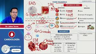 FIEBRE REUMATICA  RESUMEN  CARDIOLOGÍA [upl. by Plank]