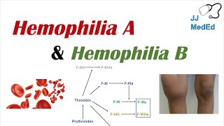 Hemophilia A vs Hemophilia B  Genetics Symptoms and Treatment [upl. by Rebak]