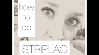 how to do STRIPLAC [upl. by Auhel]