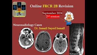 FRCR 2b Session 2 September 2024 CNS [upl. by Airdnaxila199]