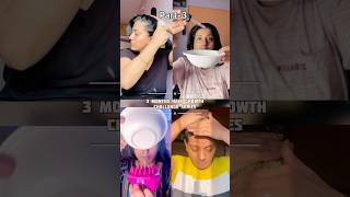 3 Months Hair Growth Challenge Series  Part3 Haircare hairgrowth shorts [upl. by Akemaj989]