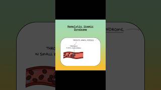 Hemolytic Uremic Syndrome shortsvideo nclex nursingexam youtubeshorts nclexexam [upl. by Kathleen]