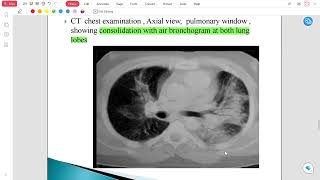 Radiology Lec 4 [upl. by Bilski]