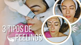 Limpeza de pele personalizada com 3 tipos de peelings na mesma sessão Pele Eudérmica [upl. by Atiuqat]