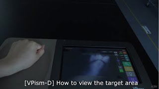 VPismD How to view the target area [upl. by Cristionna362]