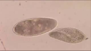 Paramecium caudatum [upl. by Hillard]