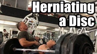 Herniating a Disc During Deadlifts [upl. by Mahgirb]