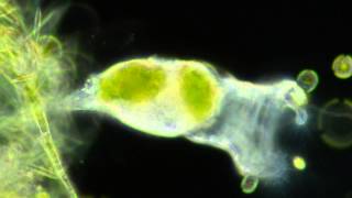 Rotifers Feeding [upl. by Wagner671]