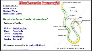 Wuchereria Filarial Worm [upl. by Korwun]