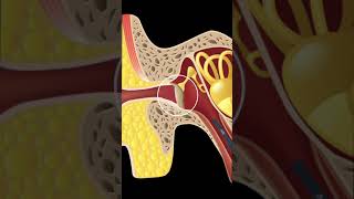 RETRACTED EARDRUMRETRACTION POCKETS EXPLAINED SHORTS [upl. by Xirtaeb239]