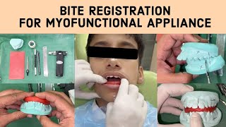 🔵 Step by Step Demonstration on Bite Registration For Myofunctional Appliance in Orthodontics [upl. by Sitelc]