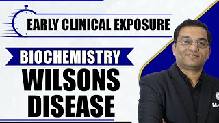 Wilsons Disease Biochemistry  1st Year MBBS  Early Clinical Exposure  Dr Rajesh [upl. by Nnil144]