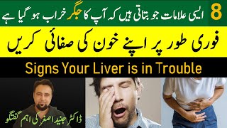 8 Warning Signs of Liver Disease  लिवर रोग के 8 चेतावनी संकेत [upl. by Merrell]