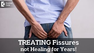 Best ways to manage Fissures that are not healing for long time  Dr Nanda RajneeshDoctors Circle [upl. by Orton290]