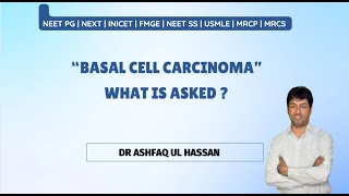 Basal Cell Carcinoma for Neet Pg  FMGE MBBS INICET Dermatology Surgery Residents [upl. by Wildermuth]