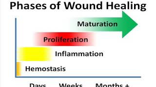 Process of Wound Healing [upl. by Preciosa91]