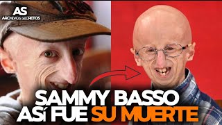 SAMMY BASSO y la Enfermedad de  HutchinsonGilford  que acabóPoco A poco con su vida [upl. by Fernanda454]