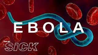 What Ebola Does to the Body [upl. by Irolam]