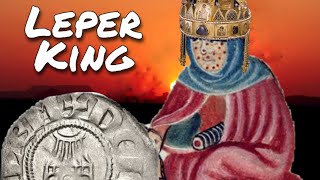 Crusader Coins Two Brothers and a Leper King [upl. by Drhacir]