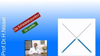 Schädelakupunktur  anschaulich demonstriert [upl. by Icram]