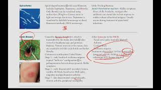 Spirochetes Lyme disease  Microbiology  24  First Aid USMLE in UrduHindi [upl. by Hendrik764]